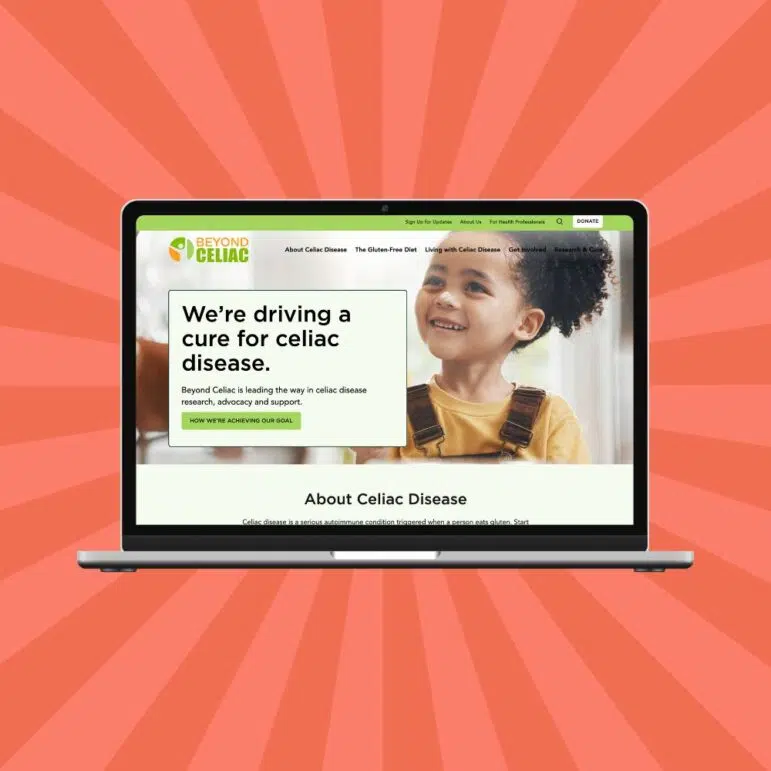 A laptop displaying the Beyond Celiac website homepage, showcasing effective nonprofit web design with a banner of a smiling child and text about driving a cure for celiac disease. The laptop sits against a red background with radiating lines.